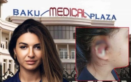 6 yaşlı Ahu-nun qulağı əməliyyat zamanı çürüdü – Ana həkim Günel Məmmədlidən şikayətçidir