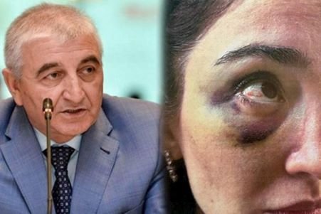 “Növbəti işgəncədən sonra pasportumu götürüb qaçdım” - MSK sədrinin gəlini